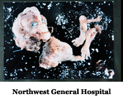 Northwest General Hospital